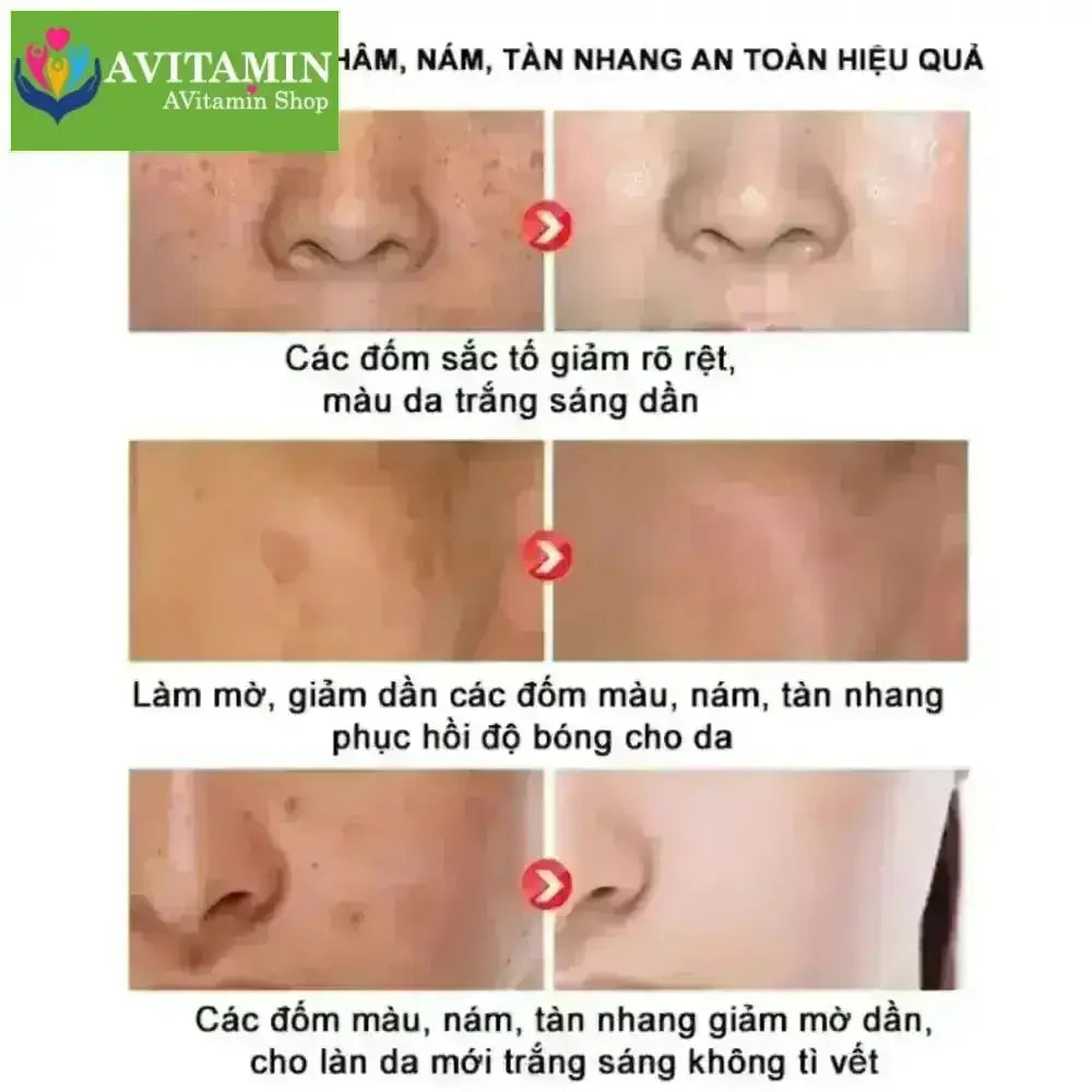 Kem Nám Tàn Nhang Nhân Sâm CNXUER Hộp 60g Kem Mờ Thâm Nám Tàn Nhang Dưỡng Ẩm Sáng Da Ngừa Lão Hóa - AVITAMINSHOP.COM