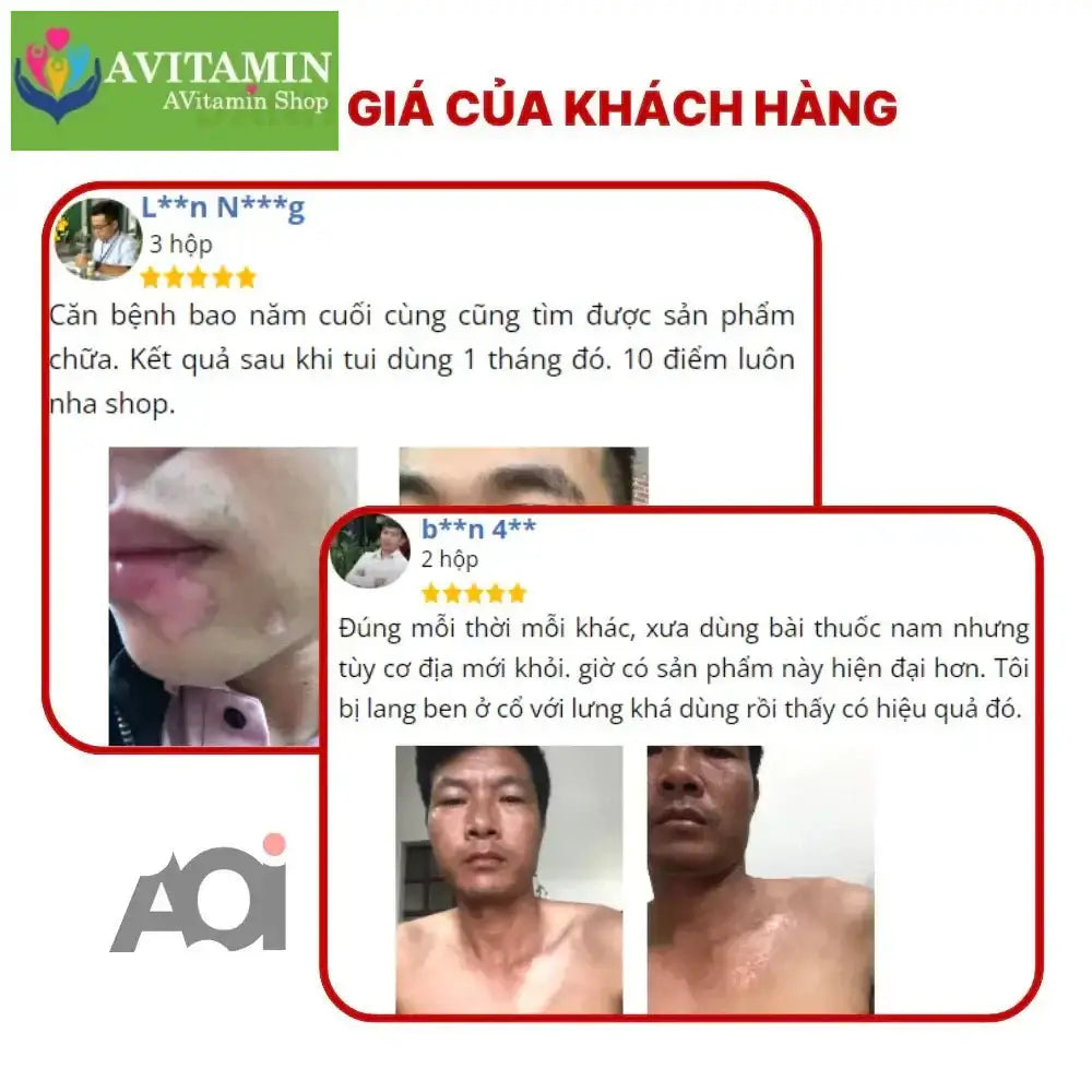 Cao Bôi Lang Ben Sakimi Cổ Truyền Nhật Bản 30ml - Loại Bỏ Đốm Trắng Lang Ben, Bạch Biến, Hắc Lào Hiệu Quả, Tái Tạo Da - AVITAMINSHOP.COM