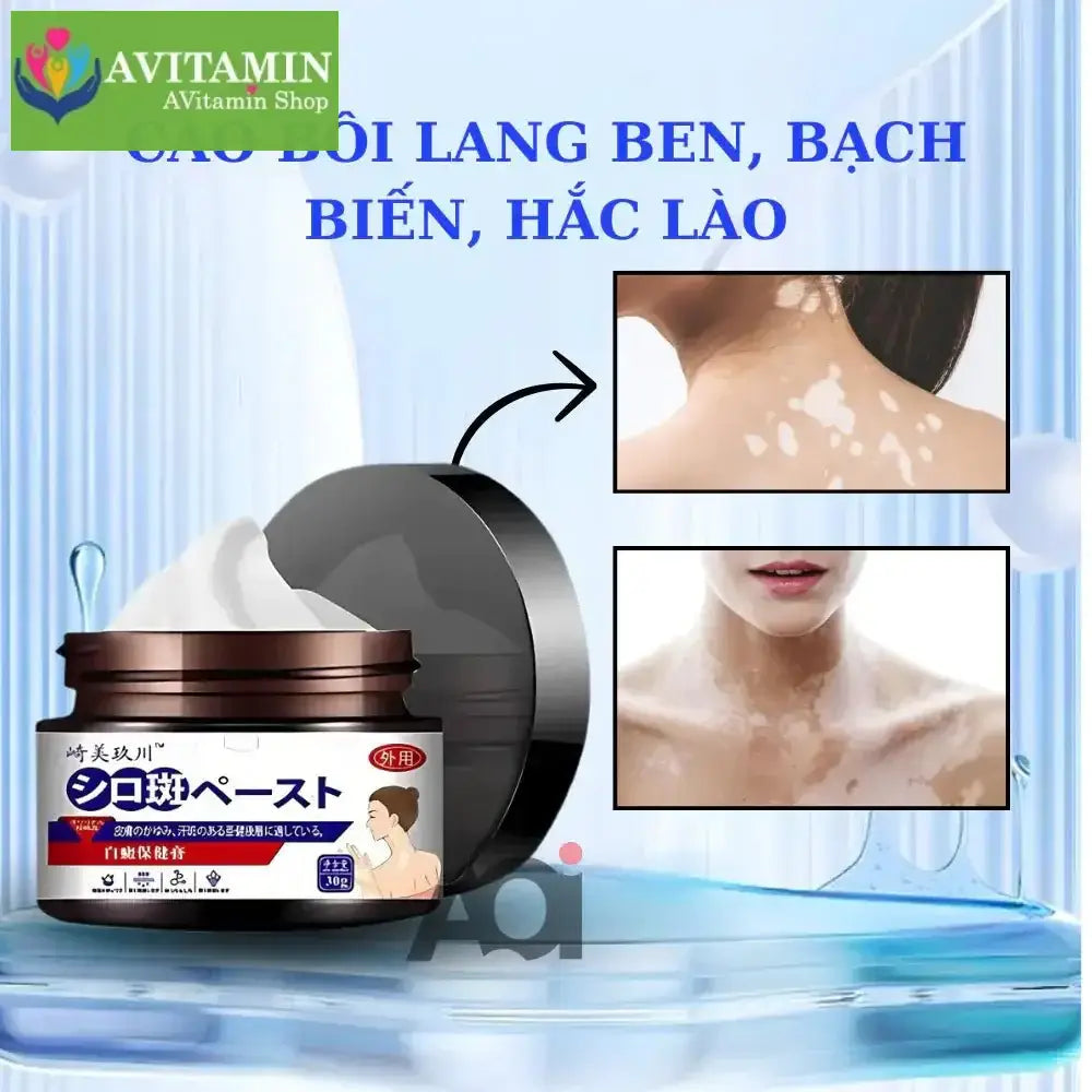 Cao Bôi Lang Ben Sakimi Cổ Truyền Nhật Bản 30ml - Loại Bỏ Đốm Trắng Lang Ben, Bạch Biến, Hắc Lào Hiệu Quả, Tái Tạo Da - AVITAMINSHOP.COM