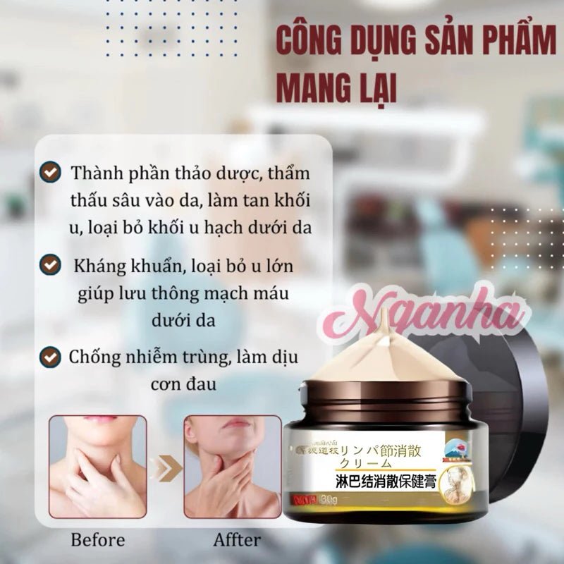 Cao tan hạch bạch huyết SHIXENDO Nhật Bản 30g, Kem bôi tan hạch Nhật Bản, teo u hạch, loại bỏ u hạch to, hết sưng đau - AVITAMINSHOP.COM