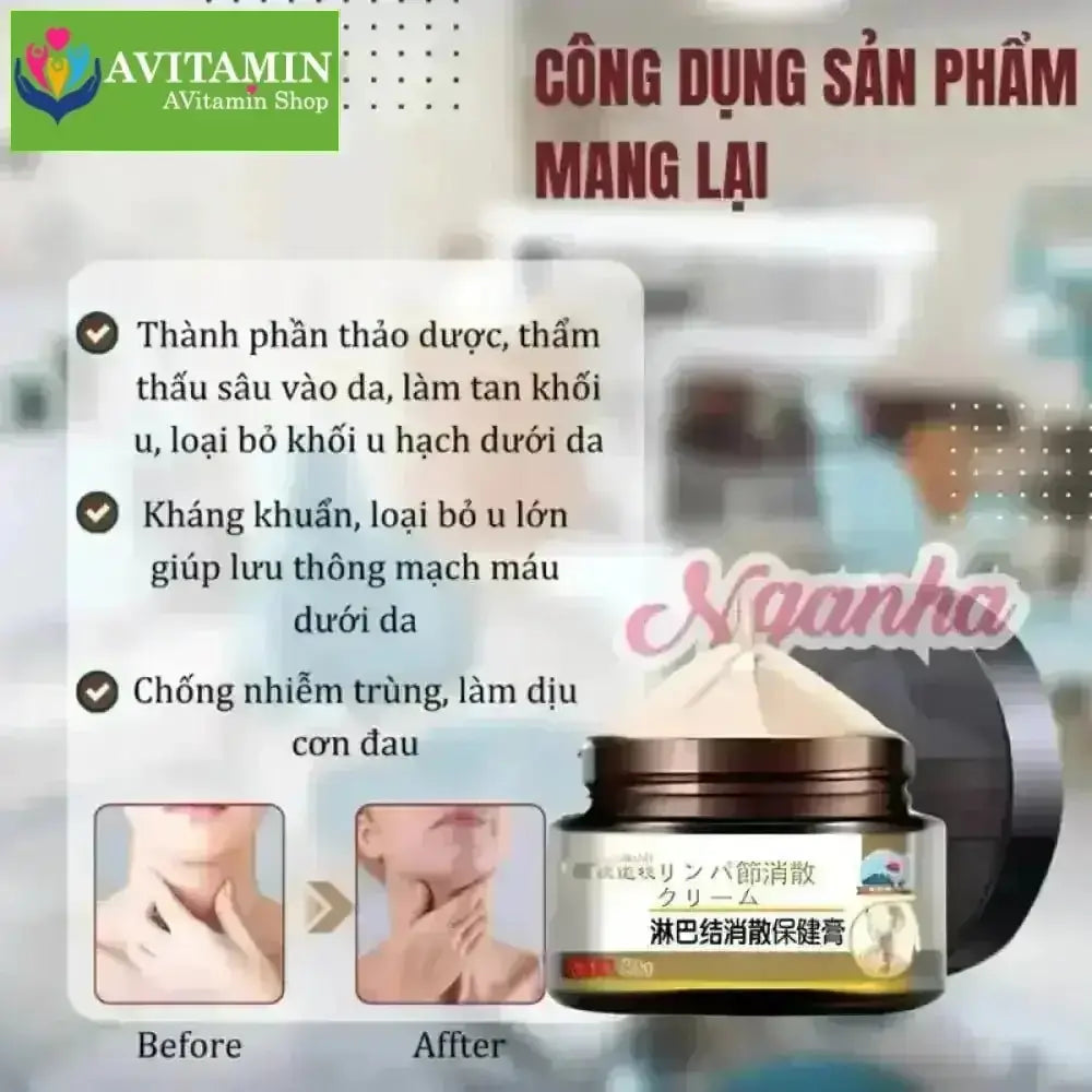 Cao tan hạch bạch huyết SHIXENDO Nhật Bản 30g, Kem bôi tan hạch Nhật Bản, teo u hạch, loại bỏ u hạch to, hết sưng đau - AVITAMINSHOP.COM