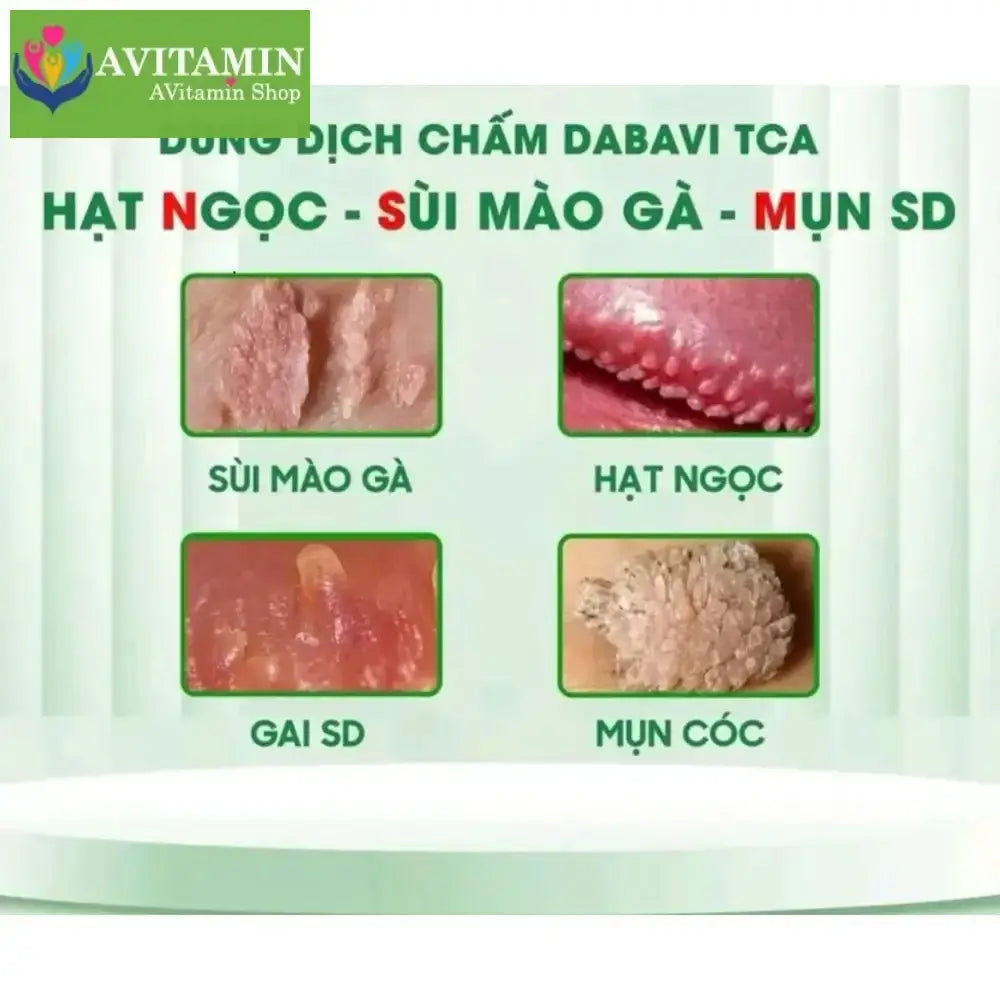 (Che Tên) Dung dịch chấm rụng hạt ngọc, sùi MG TCA DABAVIR hỗ trợ cải thiện nốt mụn liti, gai SG - AVITAMINSHOP.COM