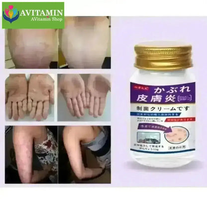 [CHÍNH HÃNG] Kem Bôi Da Liễu Nakusa Nấm Hắc Lào Vẩy Nến Á Sừng Tổ Đỉa Nguyên Liệu Nhập khẩu Nhật 55G - AVITAMINSHOP.COM