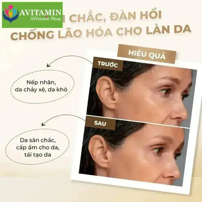 Combo 10 Miếng Mặt Nạ Trắng Da Chống Lão Hoá Laon Fresh Meso Essence Mask Lifting Care Whitening Nourishing 30mlx10 - AVITAMINSHOP.COM
