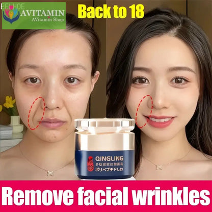 [Đảm bảo chính hãng] Kem loại bỏ nếp nhăn Qingling Chống lão hóa Hydrating Firming EELHOE Dưỡng ẩm