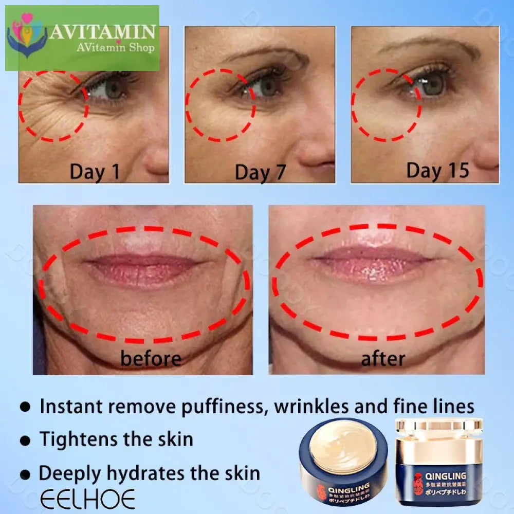 [Đảm bảo chính hãng] Kem loại bỏ nếp nhăn Qingling Chống lão hóa Hydrating Firming EELHOE Dưỡng ẩm
