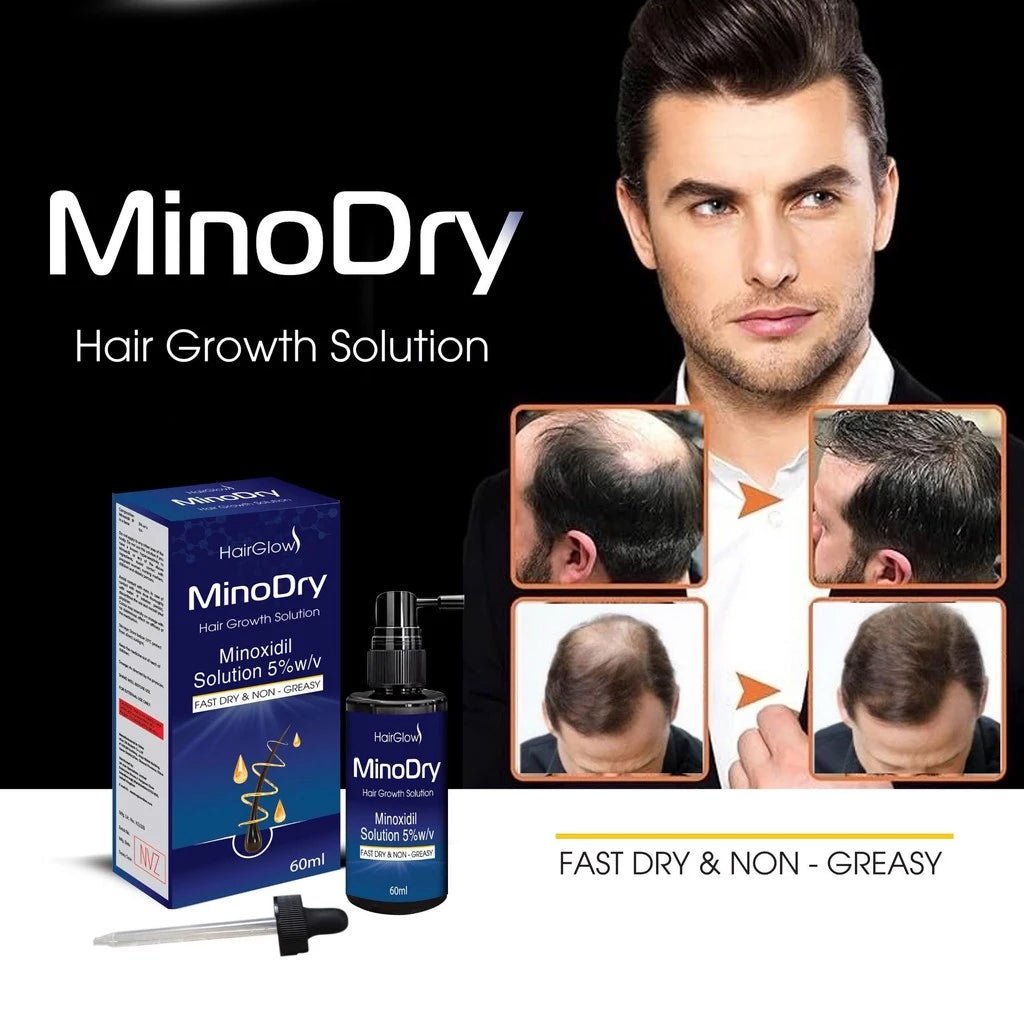 Dung dịch mọc tóc MinoDry Minoxidil 5% (DẠNG LỎNG) - AVITAMINSHOP.COM