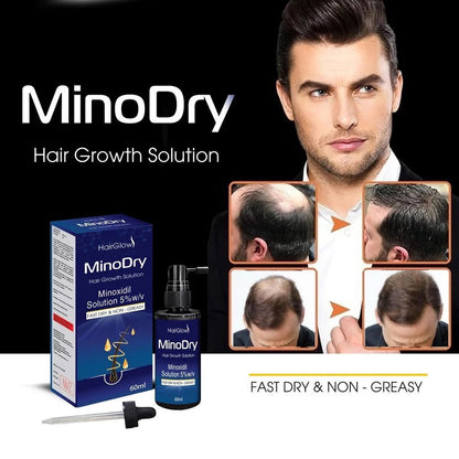 Dung dịch mọc tóc MinoDry Minoxidil 5% (DẠNG LỎNG) - AVITAMINSHOP.COM