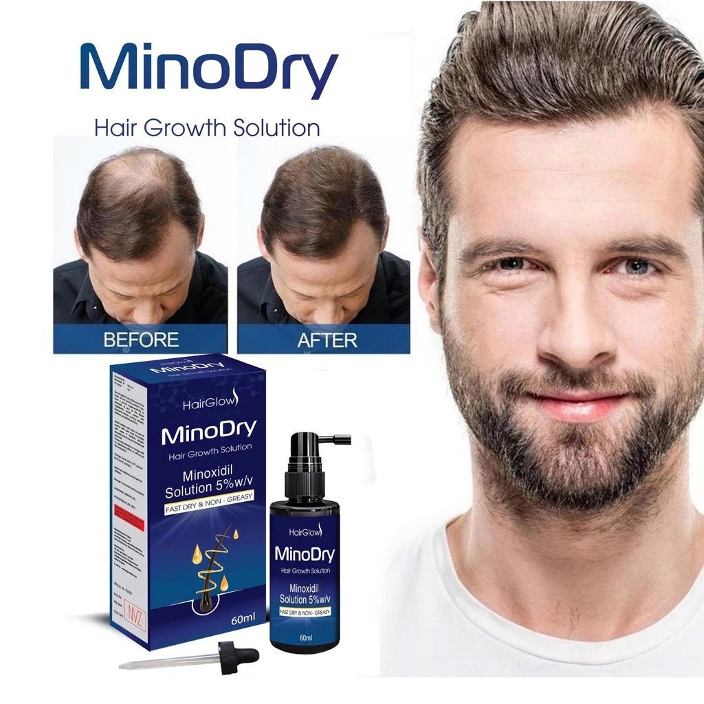 Dung dịch mọc tóc MinoDry Minoxidil 5% (DẠNG LỎNG) - AVITAMINSHOP.COM