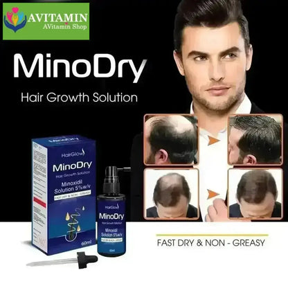 Dung dịch mọc tóc MinoDry Minoxidil 5% (DẠNG LỎNG) - AVITAMINSHOP.COM