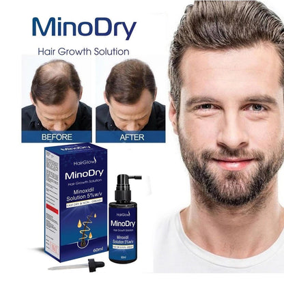 Dung dịch mọc tóc MinoDry Minoxidil 5% (DẠNG LỎNG) - AVITAMINSHOP.COM