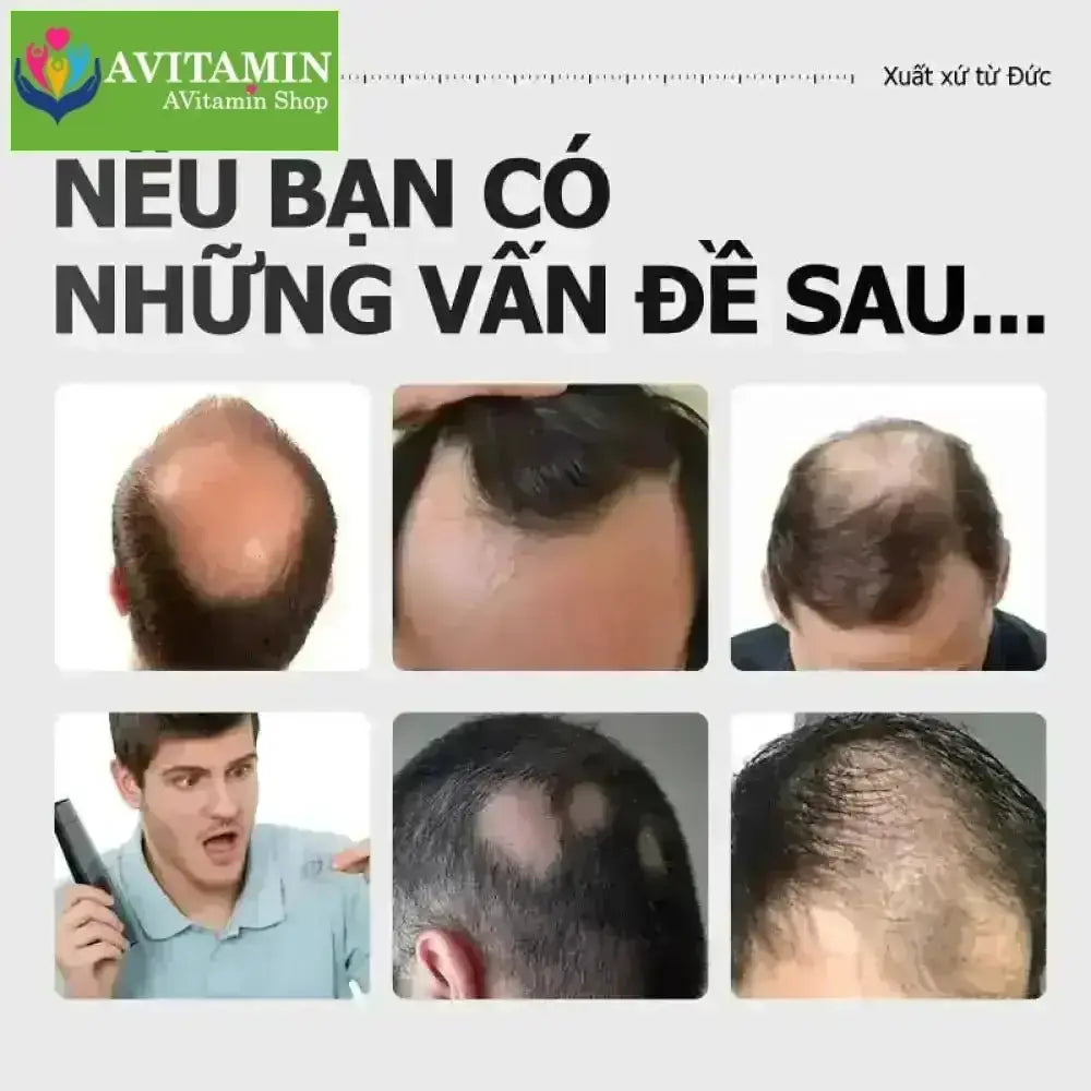 Greenvibes Xịt tinh chất mọc tóc thúc đẩy tóc đen mọc dài hỗ trợ chuyển tóc bạc thành tóc đen - AVITAMINSHOP.COM