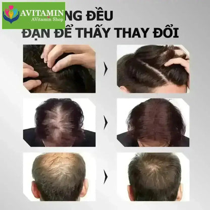 Greenvibes Xịt tinh chất mọc tóc thúc đẩy tóc đen mọc dài hỗ trợ chuyển tóc bạc thành tóc đen - AVITAMINSHOP.COM