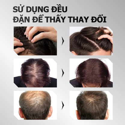 Greenvibes Xịt tinh chất mọc tóc thúc đẩy tóc đen mọc dài hỗ trợ chuyển tóc bạc thành tóc đen - AVITAMINSHOP.COM