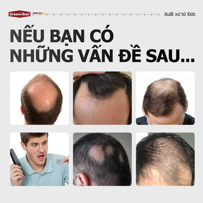 Greenvibes Xịt tinh chất mọc tóc thúc đẩy tóc đen mọc dài hỗ trợ chuyển tóc bạc thành tóc đen - AVITAMINSHOP.COM