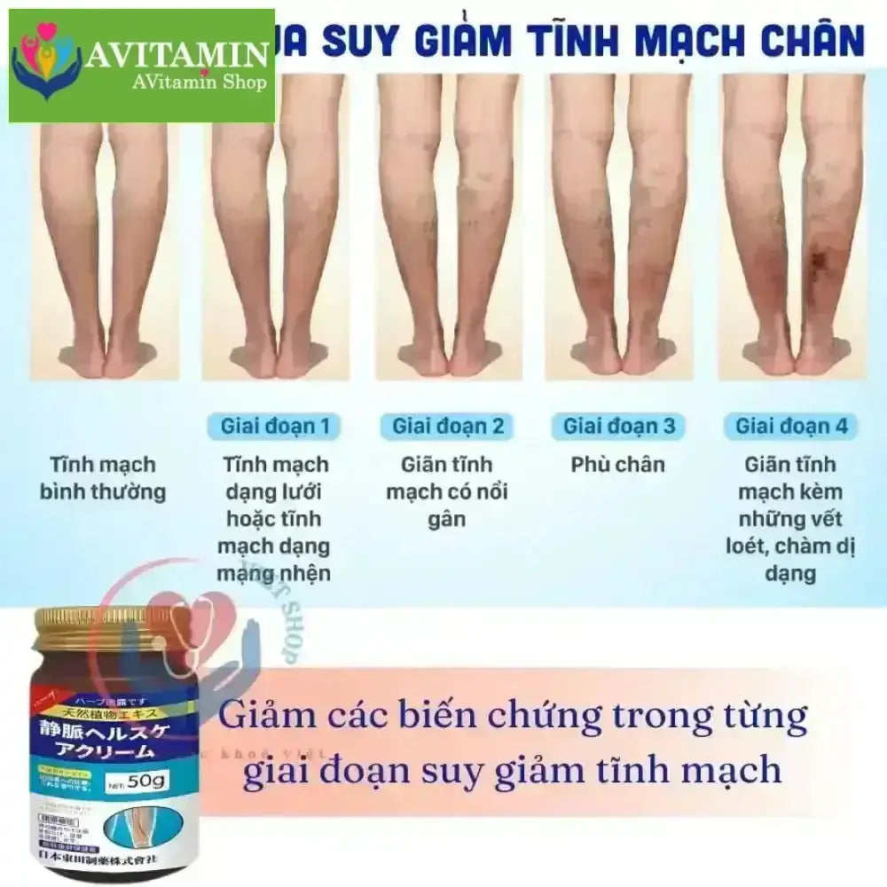 KEM BÔI GIÃN TĨNH MẠCH CHÂN SENJOKO 50G NHẬT BẢN, TĂNG TUẦN HOÀN MÁU, GIẢM ĐAU NHỨC, GIẢM PHÙ NỀ, ĐAU - AVITAMINSHOP.COM