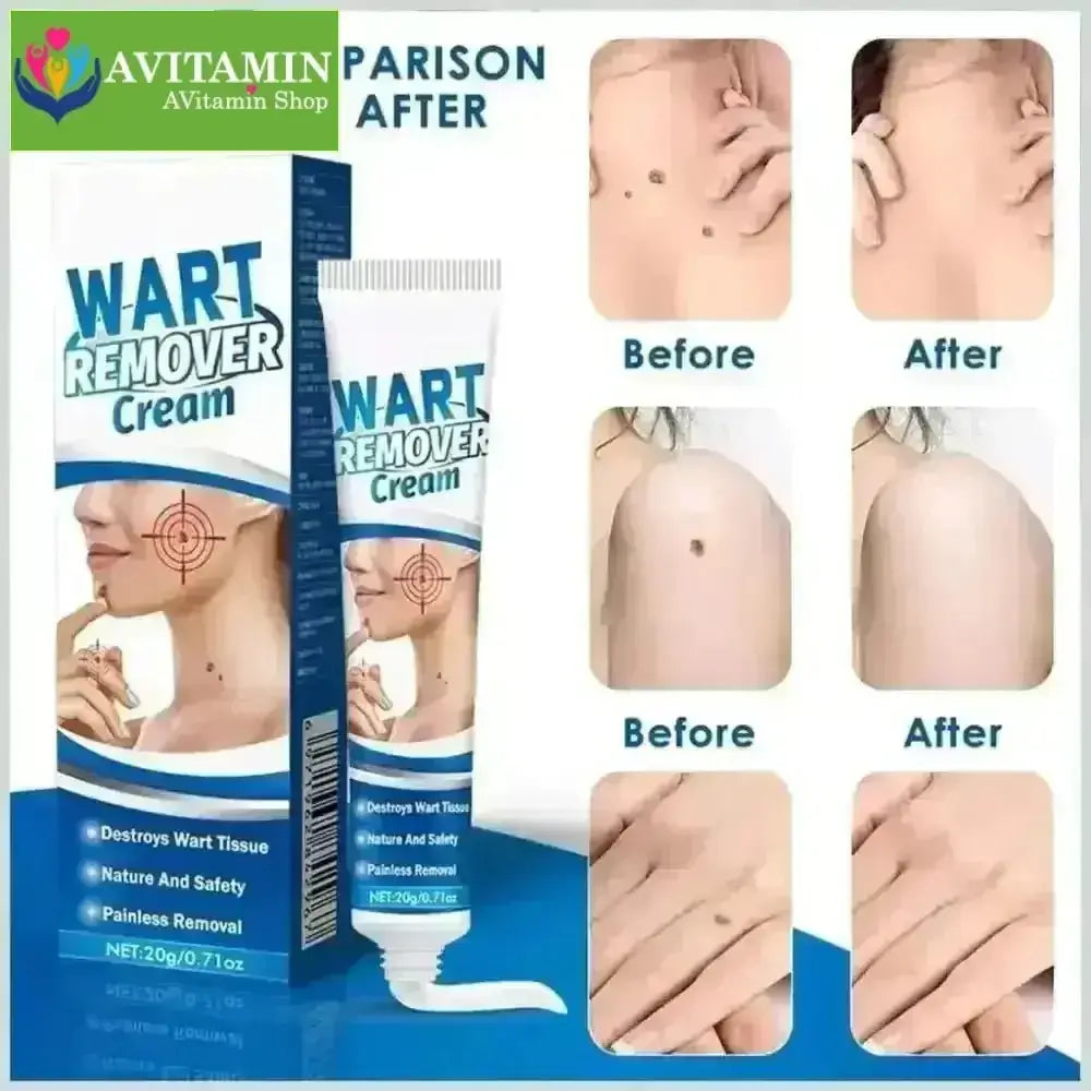 Kem Bôi Mụn Thịt Dư HBESTY WART REMOVER CREAM - Kem HBESTY Rụng Cồi Mụn, Rụng Mụn Thịt Dư, Không Đau Ngứa - AVITAMINSHOP.COM