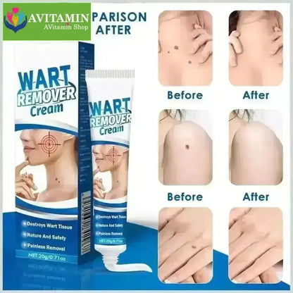 Kem Bôi Mụn Thịt Dư HBESTY WART REMOVER CREAM - Kem HBESTY Rụng Cồi Mụn, Rụng Mụn Thịt Dư, Không Đau Ngứa - AVITAMINSHOP.COM