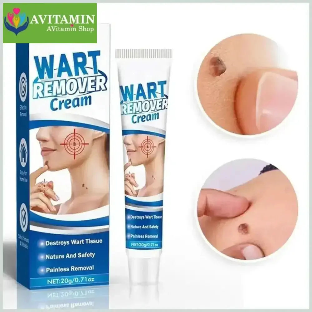 Kem Bôi Mụn Thịt Dư HBESTY WART REMOVER CREAM - Kem HBESTY Rụng Cồi Mụn, Rụng Mụn Thịt Dư, Không Đau Ngứa - AVITAMINSHOP.COM