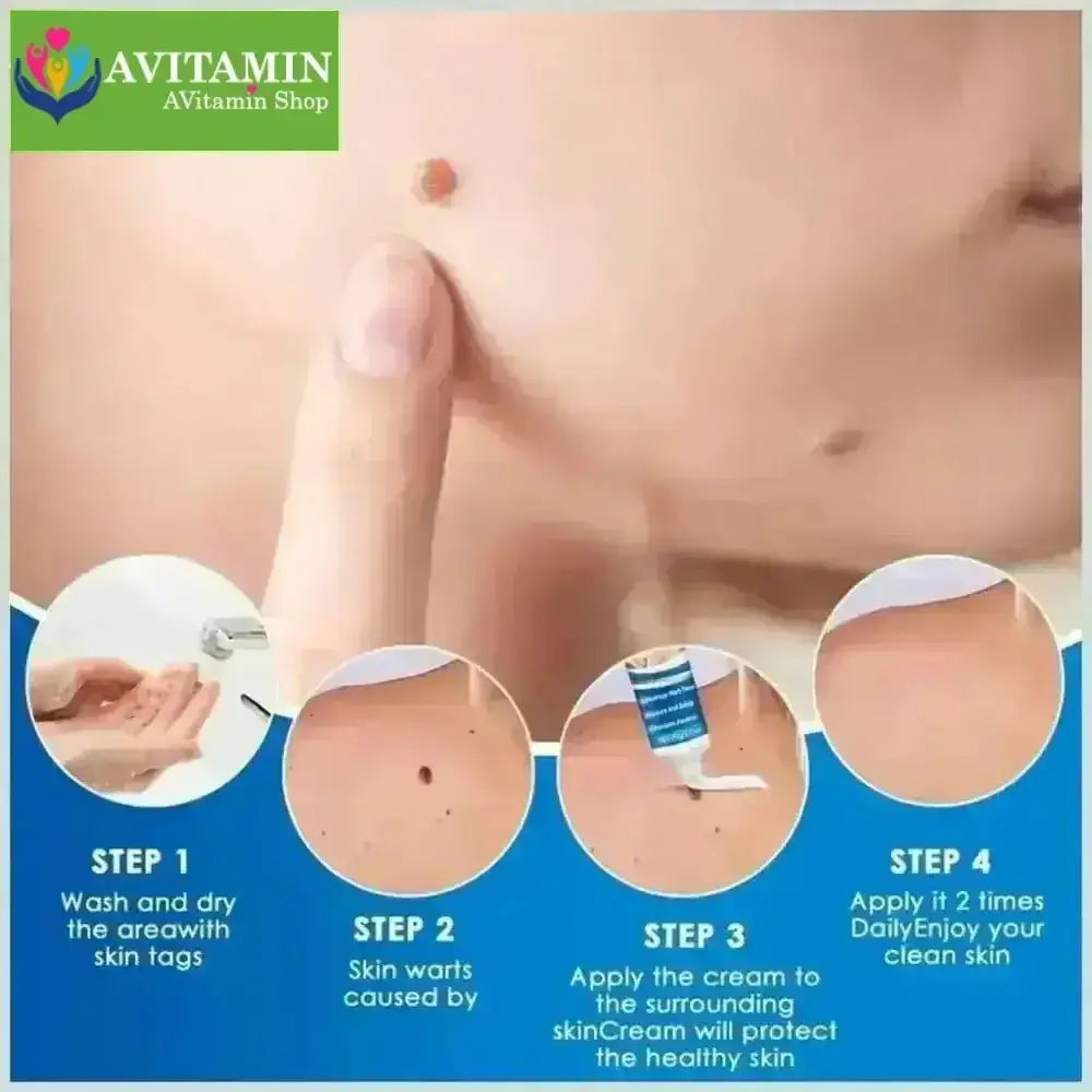 Kem Bôi Mụn Thịt Dư HBESTY WART REMOVER CREAM - Kem HBESTY Rụng Cồi Mụn, Rụng Mụn Thịt Dư, Không Đau Ngứa - AVITAMINSHOP.COM