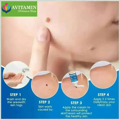 Kem Bôi Mụn Thịt Dư HBESTY WART REMOVER CREAM - Kem HBESTY Rụng Cồi Mụn, Rụng Mụn Thịt Dư, Không Đau Ngứa - AVITAMINSHOP.COM