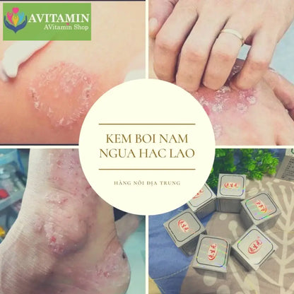 Kem bôi nấm ngứa lang ben bạch biến hắc lào