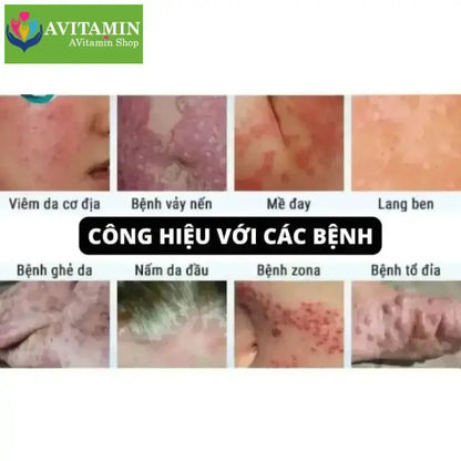 Kem bôi nấm ngứa ngoài da nội địa trung( xanh lá) - AVITAMINSHOP.COM