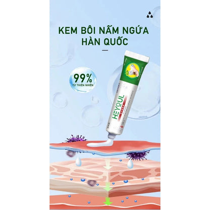 Kem bôi ngoài da HEYOUL Hàn Quốc á sừng, chàm, tổ đỉa, nấm hắc lào, viêm da cơ địa trọng lượng 20gr - AVITAMINSHOP.COM