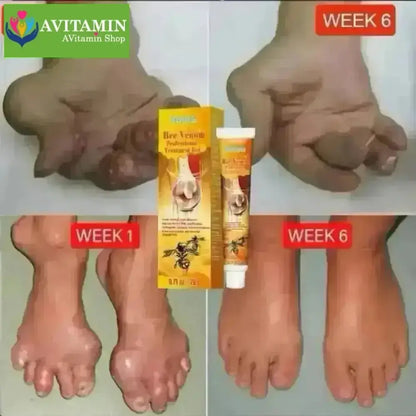 Kem Bôi Nọc Ong Hỗ Trợ Giảm Đau Nhức Xương Khớp Meniscus Pain Relief Ointment - AVITAMINSHOP.COM