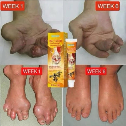 Kem Bôi Nọc Ong Hỗ Trợ Giảm Đau Nhức Xương Khớp Meniscus Pain Relief Ointment - AVITAMINSHOP.COM