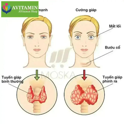 Kem Bôi Tan U Tuyến Giáp SENJOKO Nhật Bản 50g, Kem Tan Rã Tuyến Giáp, Cao Cổ Truyền Tăng Cường Sức Khoẻ Tuyến Giáp - AVITAMINSHOP.COM