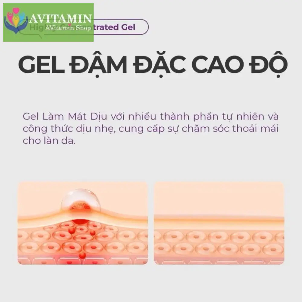 Kem Bôi Trĩ Kreain Nature Chiết Xuất Nghệ Và Thảo Mộc Hỗ Trợ Giảm Khó Chịu Chăm Sóc Da Dịu Nhẹ 20g