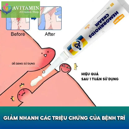 Kem Bôi Trĩ Nội Ngoại Hỗn Hợp CHA-REN Hàng Xuất Khẩu Châu Âu (EU) Giúp Co Trĩ Giảm Đau Rát Hậu Môn