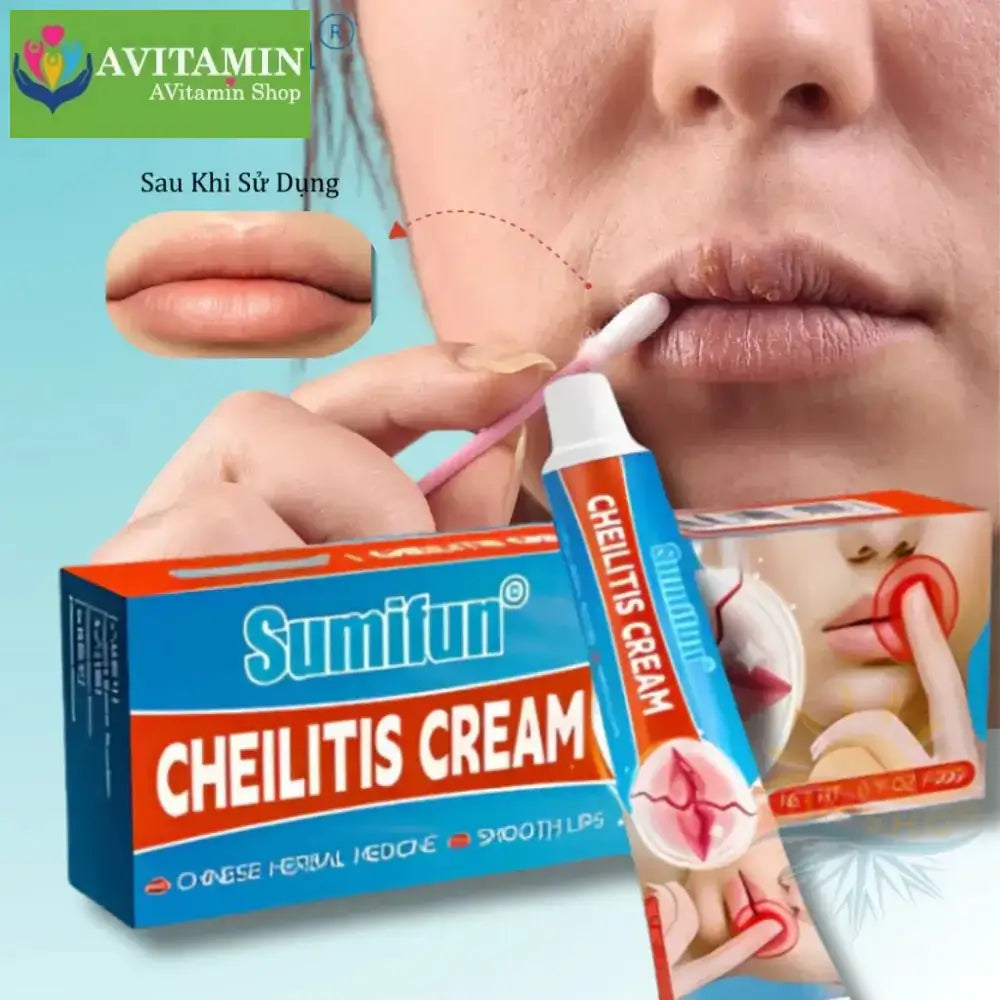Kem Bong Mụn Môi FORDYCE SUMIFUN 20gr, Khử Thâm Môi, Dưỡng Ẩm Môi, Kem Chống Nứt Nẻ Môi, Môi Mềm Mịn Hồng Mướt - AVITAMINSHOP.COM