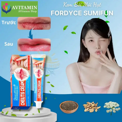 Kem Bong Mụn Môi FORDYCE SUMIFUN 20gr, Khử Thâm Môi, Dưỡng Ẩm Môi, Kem Chống Nứt Nẻ Môi, Môi Mềm Mịn Hồng Mướt - AVITAMINSHOP.COM