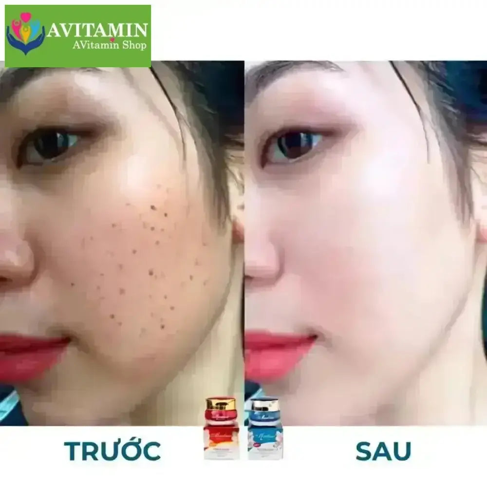 Kem Dưỡng Meiduzi Nhật Chính Hãng Dưỡng Trắng Da Mờ Thâm Sạm Nám 20gram - AVITAMINSHOP.COM