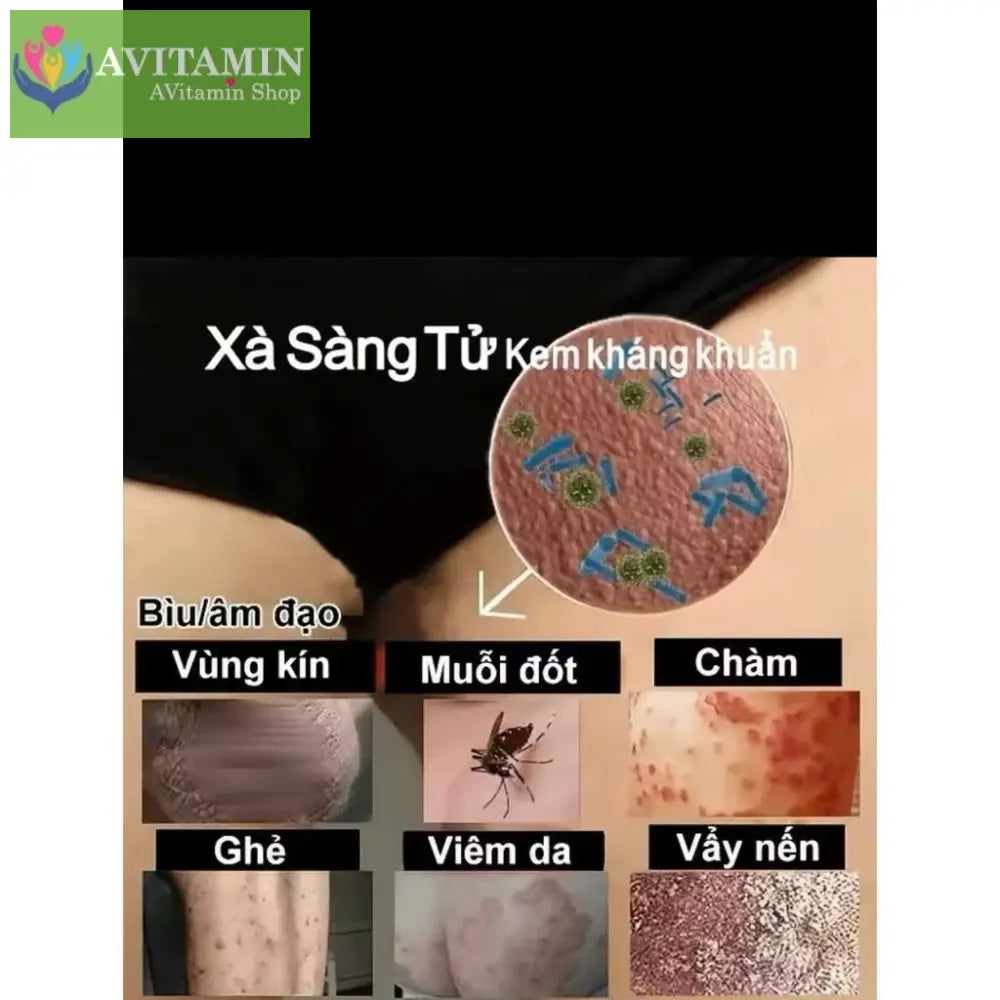Kem kháng khuẩn bôi da Pacify Xà Sàng Tử (loại 18g) giảm ngứa viêm da
