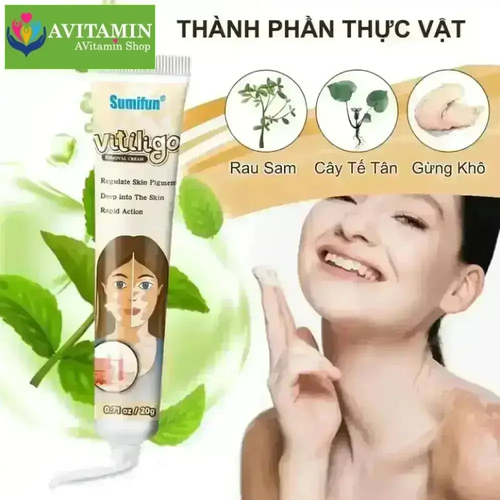 Kem lang ben kem kháng khuẩn loại bỏ bạch biến Dịu nhẹ Không kích ứng Thúc đẩy tăng trưởng hắc tố chăm sóc da 20g - AVITAMINSHOP.COM
