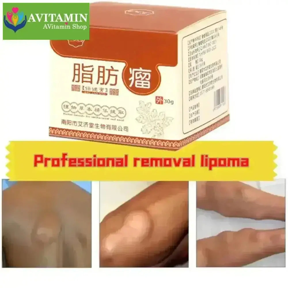 Kem loại bỏ u mỡ tan u mỡ Kem lipoma Loại bỏ mỡ dưới da 30g Tinh chất thảo mộc tự nhiên Giảm đau thần kinh gân khớp - AVITAMINSHOP.COM