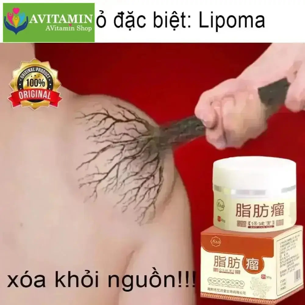 Kem loại bỏ u mỡ tan u mỡ Kem lipoma Loại bỏ mỡ dưới da 30g Tinh chất thảo mộc tự nhiên Giảm đau thần kinh gân khớp - AVITAMINSHOP.COM