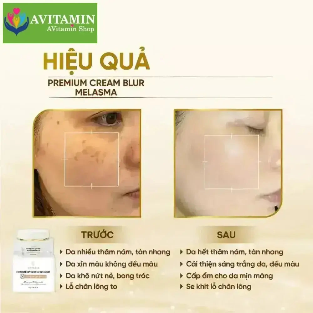Kem mờ nám tàn nhang YAHERA Premium Cream Blur Melasma mờ nám tàn nhang chống lão hoá dưỡng ẩm 30g - AVITAMINSHOP.COM
