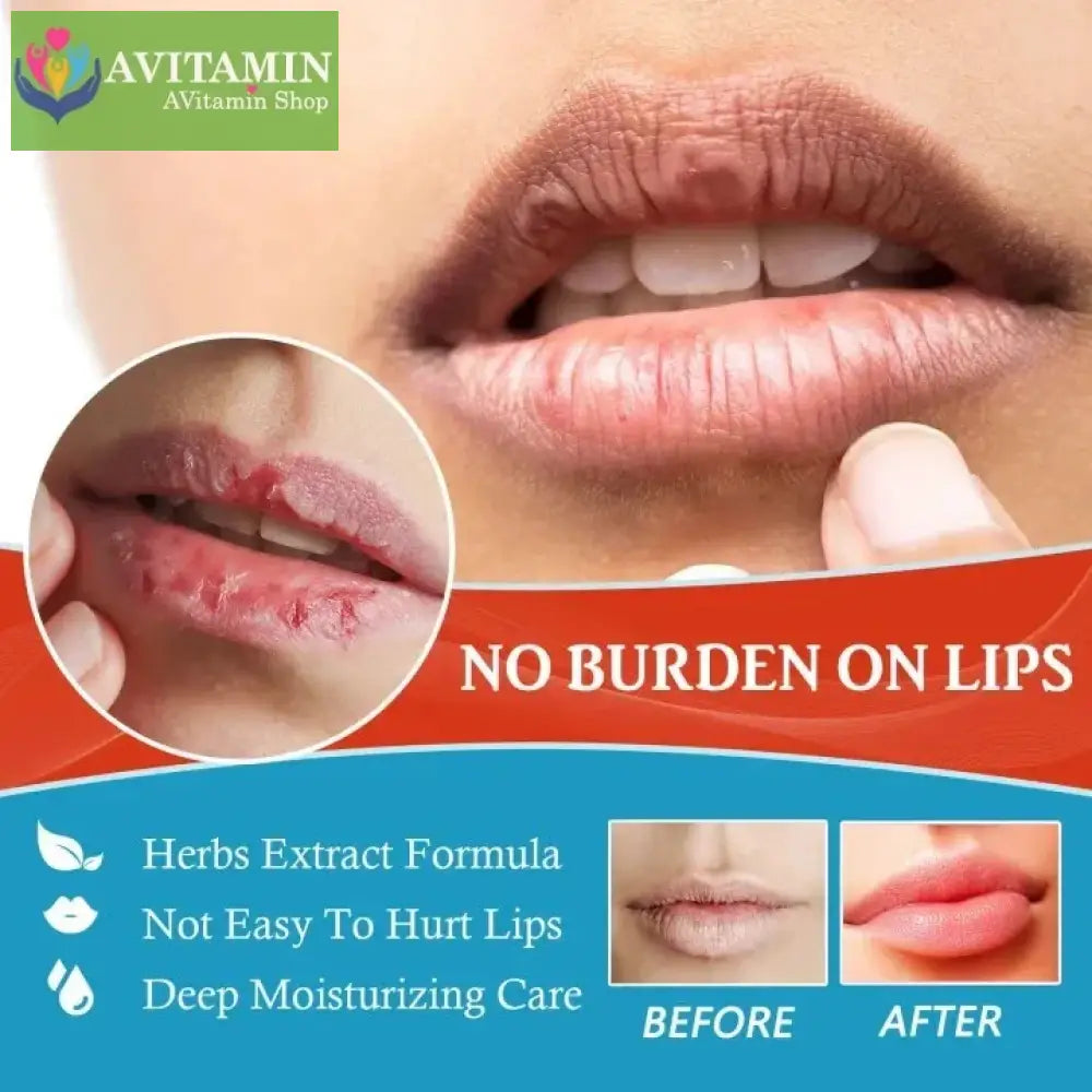 Kem mụn môi Kem dưỡng môi hạt Sumifun - Son Dưỡng Môi Khô Nứt Nẻ Bong tróc chăm sóc môi Khử Thâm Môi 20gr