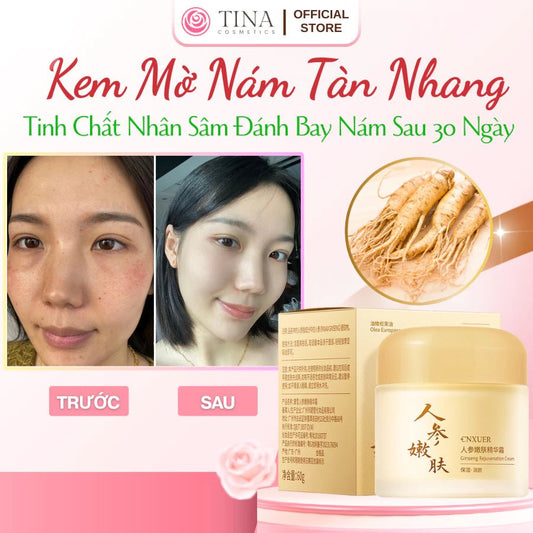 Kem Nám Tàn Nhang Nhân Sâm CNXUER Hộp 60g Kem Mờ Thâm Nám Tàn Nhang Dưỡng Ẩm Sáng Da Ngừa Lão Hóa - AVITAMINSHOP.COM