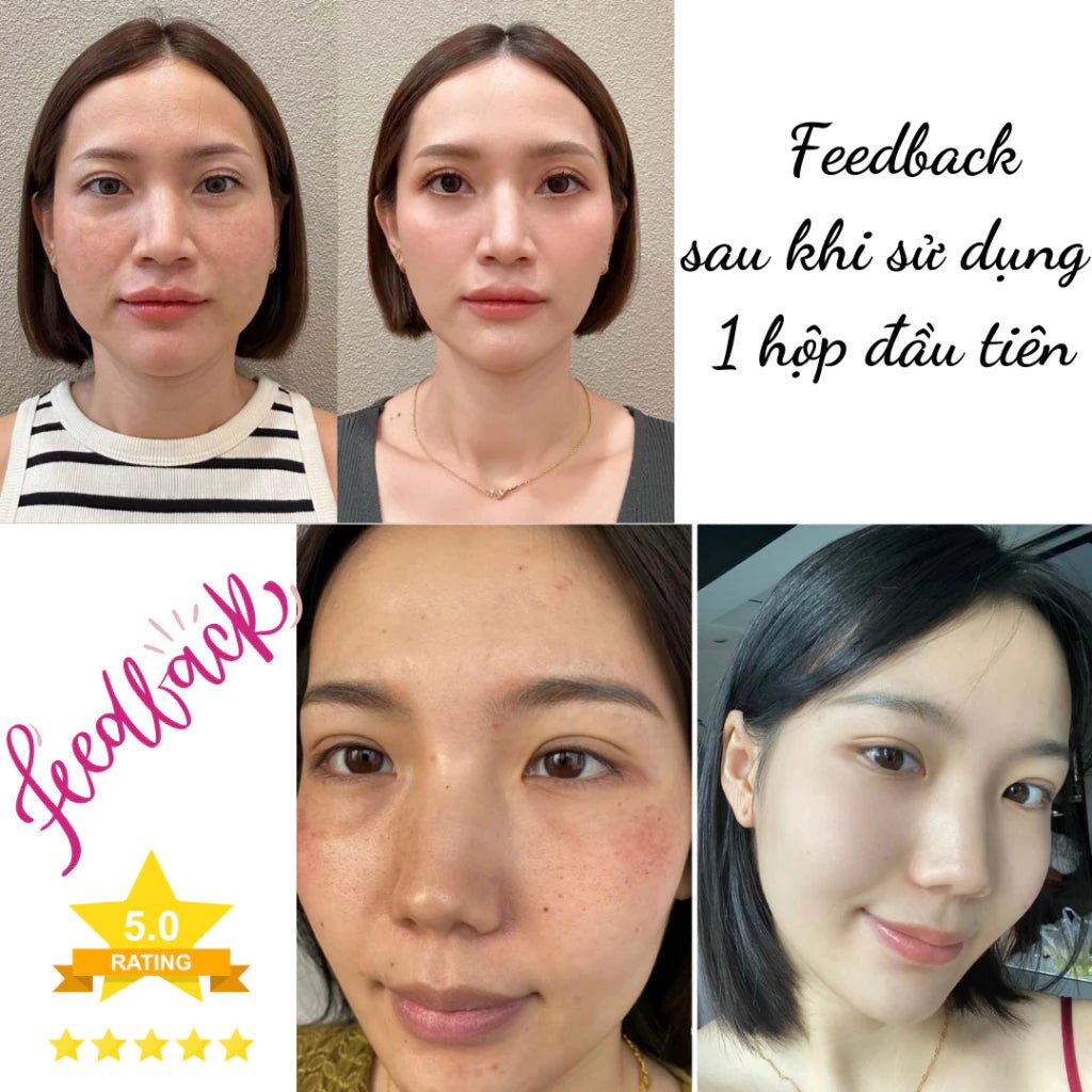 Kem Nám Tàn Nhang Nhân Sâm CNXUER Hộp 60g Kem Mờ Thâm Nám Tàn Nhang Dưỡng Ẩm Sáng Da Ngừa Lão Hóa - AVITAMINSHOP.COM