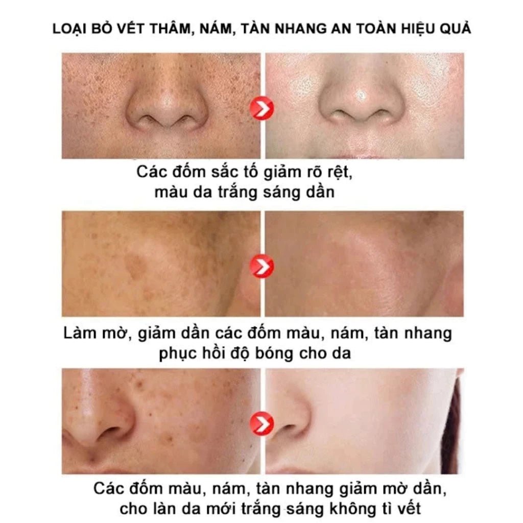 Kem Nám Tàn Nhang Nhân Sâm CNXUER Hộp 60g Kem Mờ Thâm Nám Tàn Nhang Dưỡng Ẩm Sáng Da Ngừa Lão Hóa - AVITAMINSHOP.COM