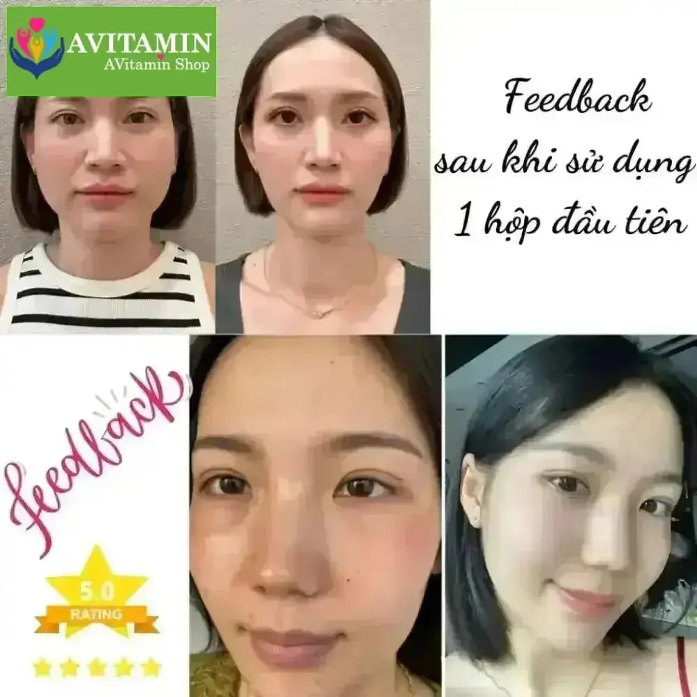 Kem Nám Tàn Nhang Nhân Sâm CNXUER Hộp 60g Kem Mờ Thâm Nám Tàn Nhang Dưỡng Ẩm Sáng Da Ngừa Lão Hóa - AVITAMINSHOP.COM