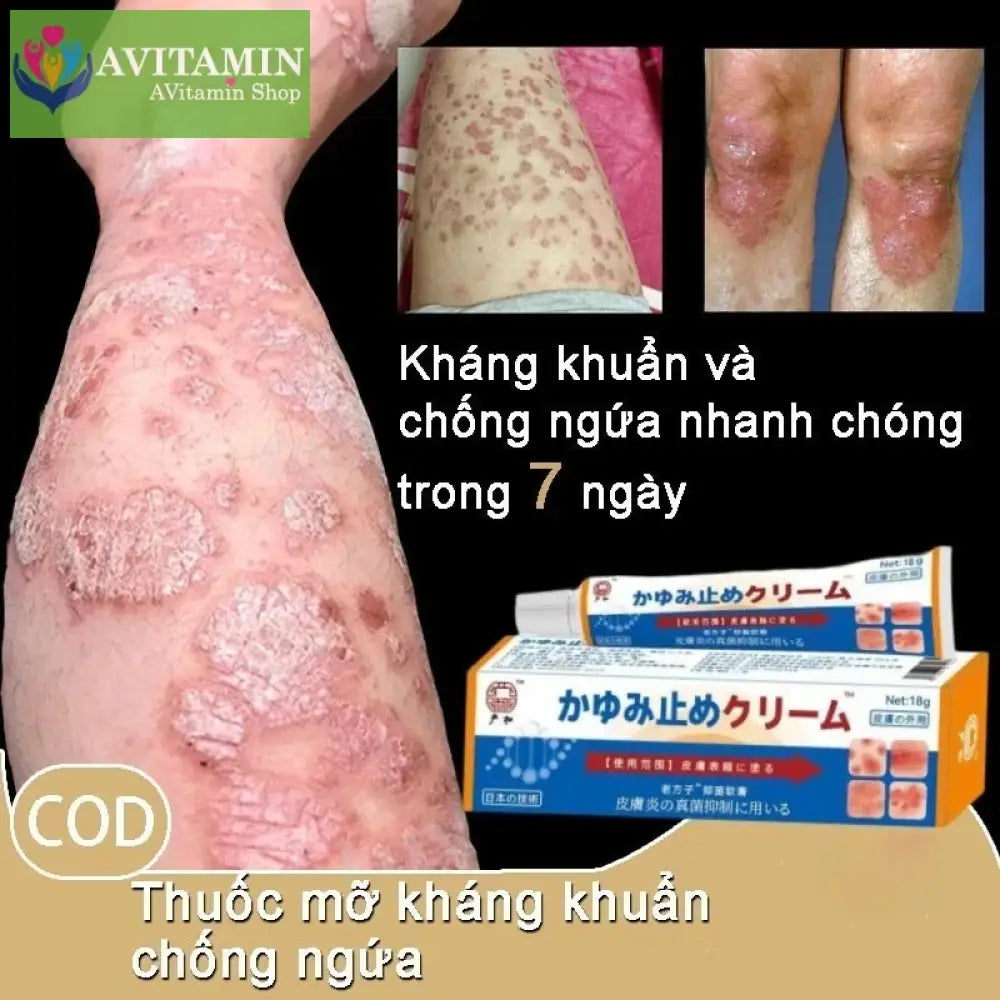 Kem Nhật Bản Bôi Nấm Kem Bôi Hắc Lào Thảo Dược Phát Ban Tổ Đĩa