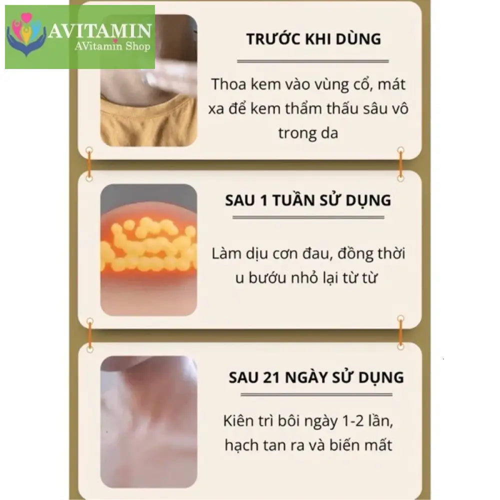 Kem tan hạch bạch huyết Shixendo dùng cho vùng cổ nách sau tai làm tan u hạch giảm sưng đỏ