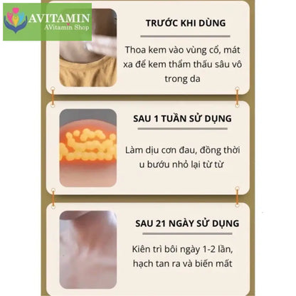 Kem tan hạch bạch huyết Shixendo dùng cho vùng cổ nách sau tai làm tan u hạch giảm sưng đỏ