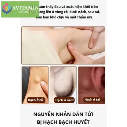 Kem tan hạch bạch huyết Shixendo dùng cho vùng cổ nách sau tai làm tan u hạch giảm sưng đỏ